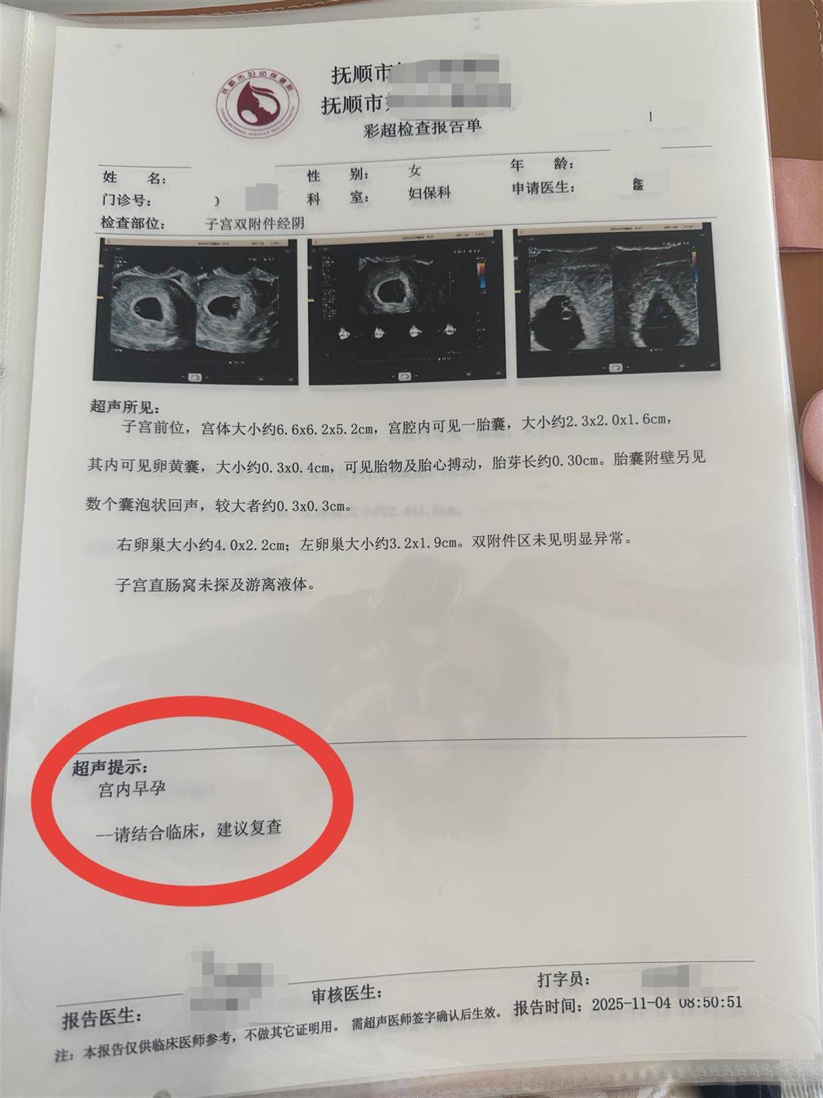 洛斯查兰特vs域堡_辽宁一孕妇两个月内从一胎变四胞胎洛斯查兰特vs域堡，每次产检发现多出一胎，医生：系同卵四胞胎，概率1300万至1500万分之一