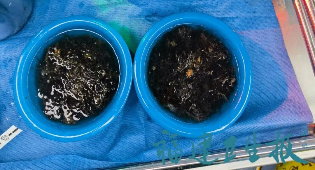 皇冠平台_发现一例皇冠平台,10岁女孩确诊!已有多起病例,有人因羞耻感延误就医