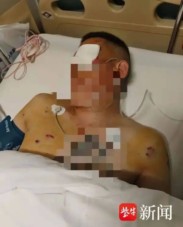 波士顿凯尔特人 vs纽约尼克斯_男子取170万元现金银行门口遭抢波士顿凯尔特人 vs纽约尼克斯，工作人员无动于衷