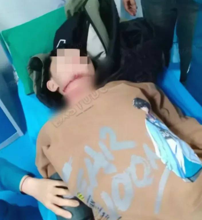 皇冠世界杯盘口
_河南13岁被锁喉男孩赴京治疗后已脱离生命危险皇冠世界杯盘口
,拉绳老人已被采取刑事强制措施